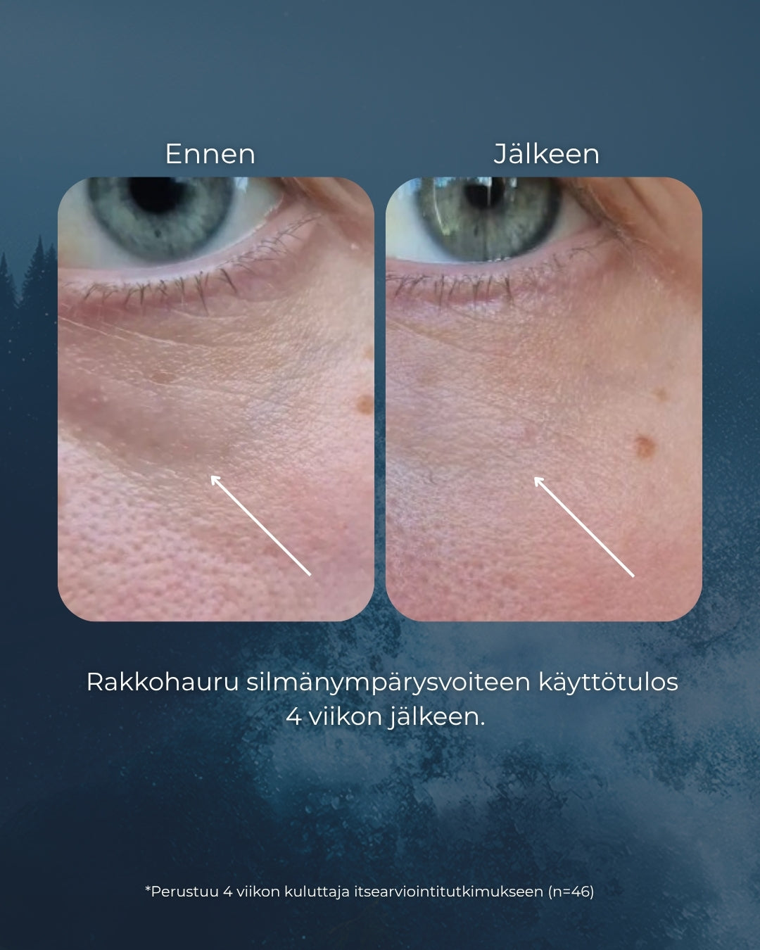 Rakkohauru silmänympärysvoide roll-on, turvotukseen, tummiin silmänalusiin ja juonteisiin, UNISEX, Oli ennen: Merikollageeni Hyaluronihappo silmänympärysgeeli