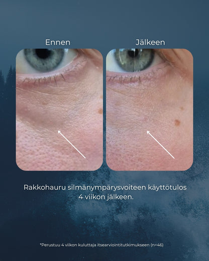 Rakkohauru silmänympärysvoide roll-on, turvotukseen, tummiin silmänalusiin ja juonteisiin, UNISEX, Oli ennen: Merikollageeni Hyaluronihappo silmänympärysgeeli