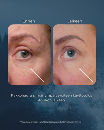 Rakkohauru silmänympärysvoide roll-on, turvotukseen, tummiin silmänalusiin ja juonteisiin, UNISEX, Oli ennen: Merikollageeni Hyaluronihappo silmänympärysgeeli