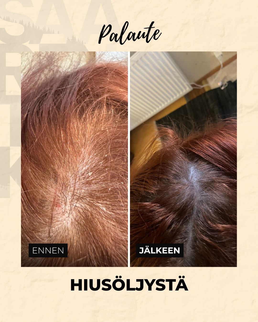 Testaajien kokemuksia Argan Tyrni hiusöljystämme, HILSE JA HIUSTENLÄHTÖ KURIIN